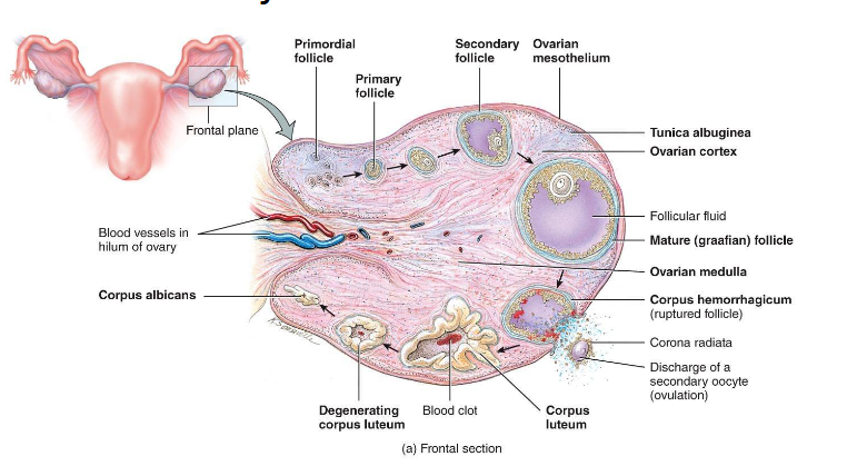 <p><span style="color: rgb(0, 0, 0);"><span>• Corpus luteum degenerates → corpus albicans</span></span><span style="color: rgb(0, 0, 0);"><br></span><span style="color: rgb(0, 0, 0);"><span>• Progesterone &amp; estrogen drop → menstruation begins</span></span><span style="color: rgb(0, 0, 0);"><br></span><span style="color: rgb(0, 0, 0);"><span>• FSH rises to start new cycle</span></span></p>