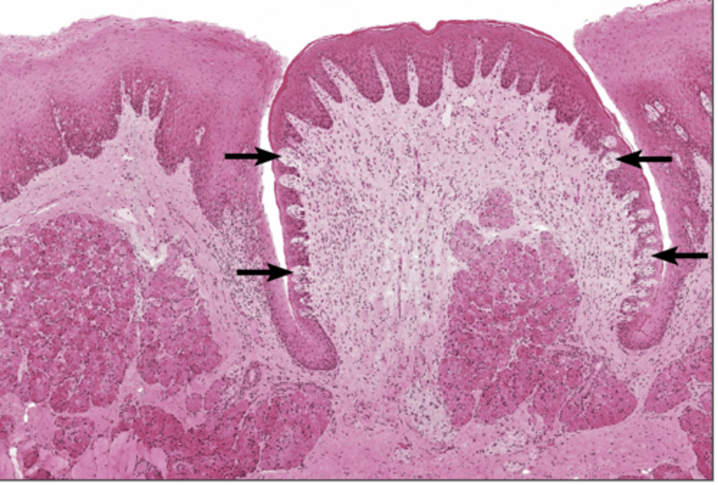 <p>sensory organs in the mouth that contain the receptors for taste</p>