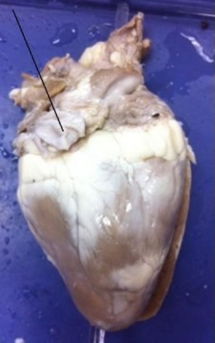 <p>Identify the blood vessel that carries blood from the lower portion of the body to the right atrium.</p>