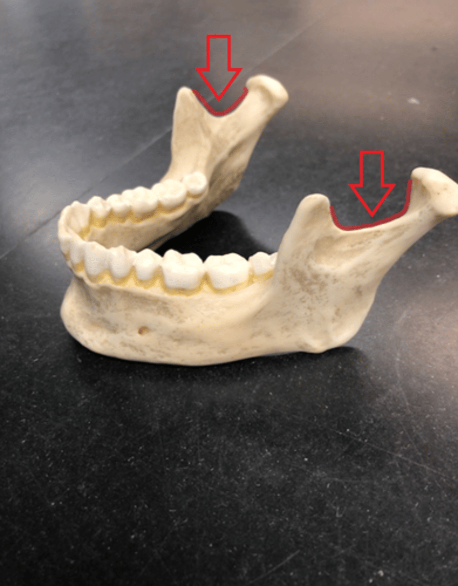 <p>Separates the condylar and coronoid processes</p>