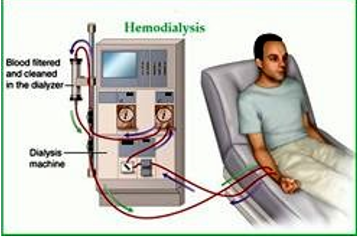 <p>what is haemodialysis </p>