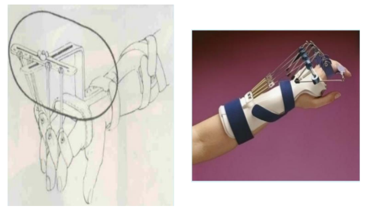 <p>Name this component of a dynamic splint. What’s its function?</p>