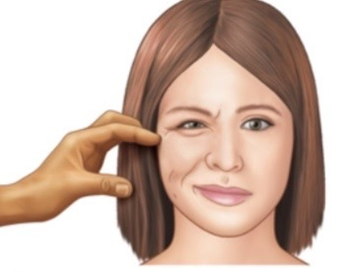 <p>spasm of the facial muscles produced by sharply tapping over the facial nerve; suggestive of hypocalcemia</p>