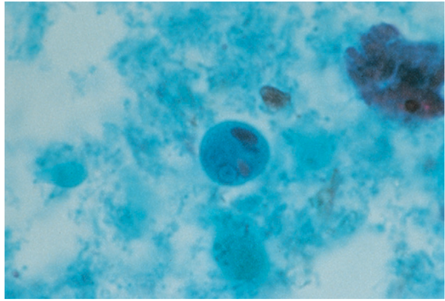 <p>A parasitic ameba that can cause amoebic dysentery.</p>