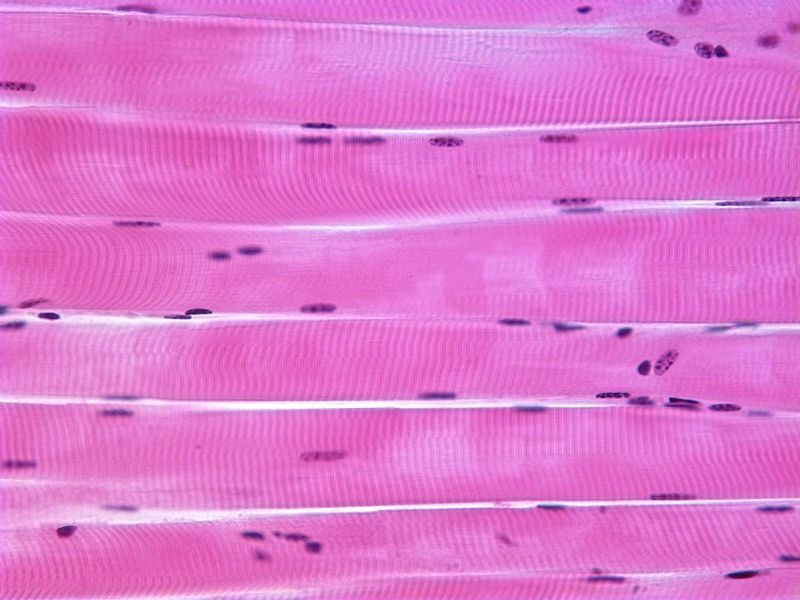 <p>Skeletal Striated Muscle</p>