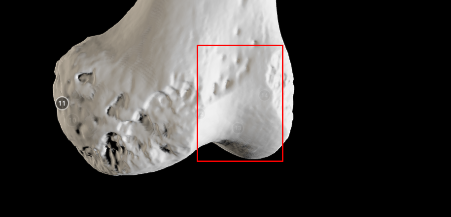 <p>patellar surface - looks like an “n” ; also bones on one side, patellar surface on the other</p>