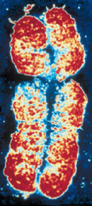 <p>DNA molecules and proteins assemble into these structures. Each contains many genes.</p>