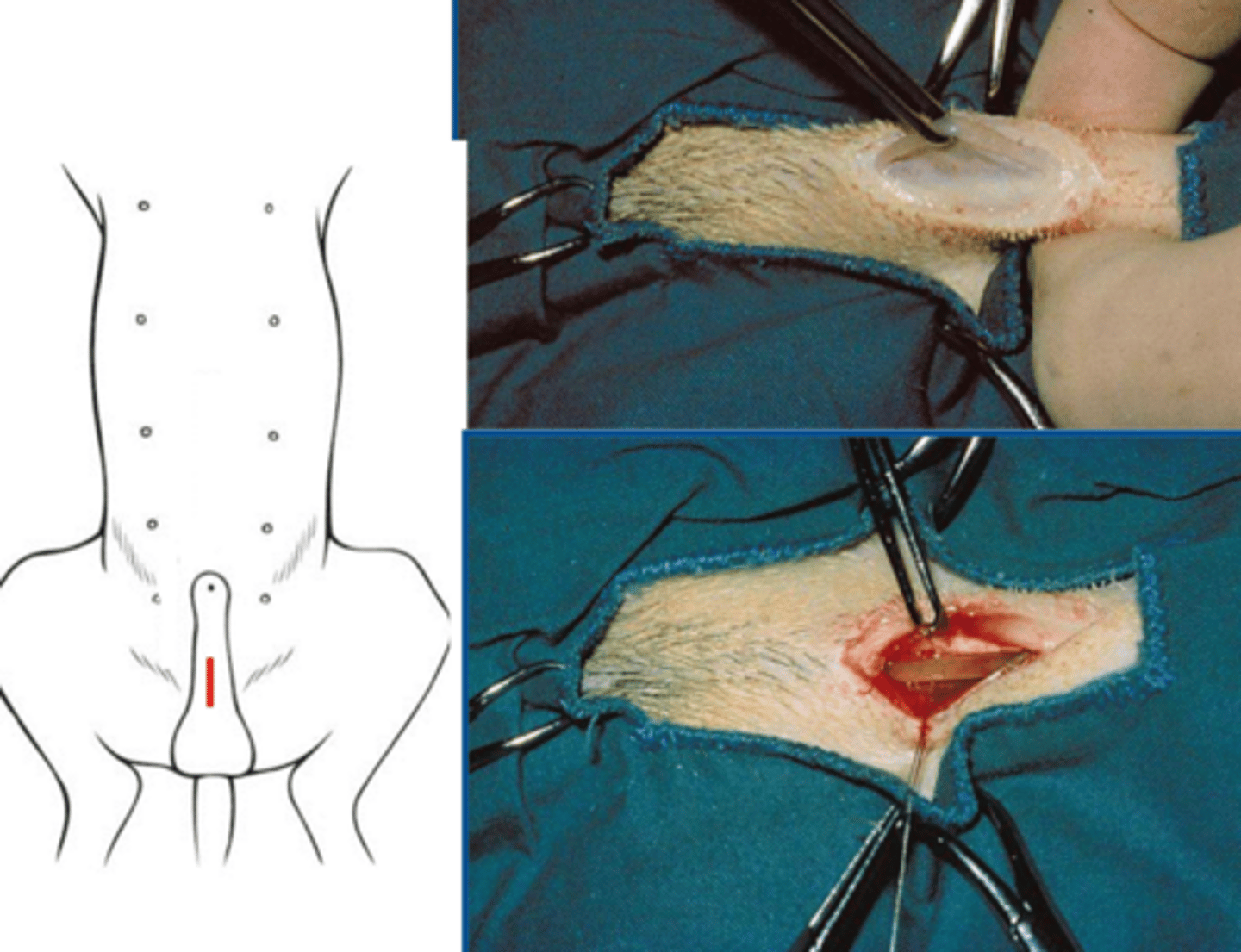 <p>general characteristics of prescrotal urethrostomy</p>