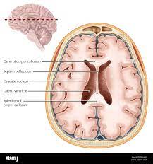 <p><span style="font-family: Franklin Gothic Book">connect directly into the brain or into the very beginnings of the spinal cord (at the brain stem), by-passing the spinal column.</span></p>