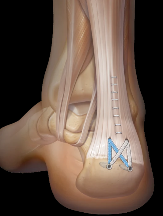 <p>What device is this?</p>