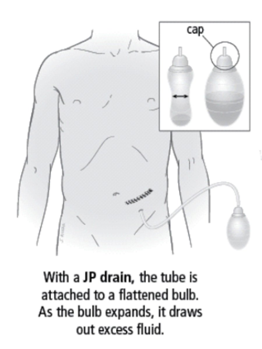 <p>Jackson-Pratt (JP) drains are ________________________ drains so they do not need to be placed below the level of the wound. Good for internal hematomas and _______________________.</p>