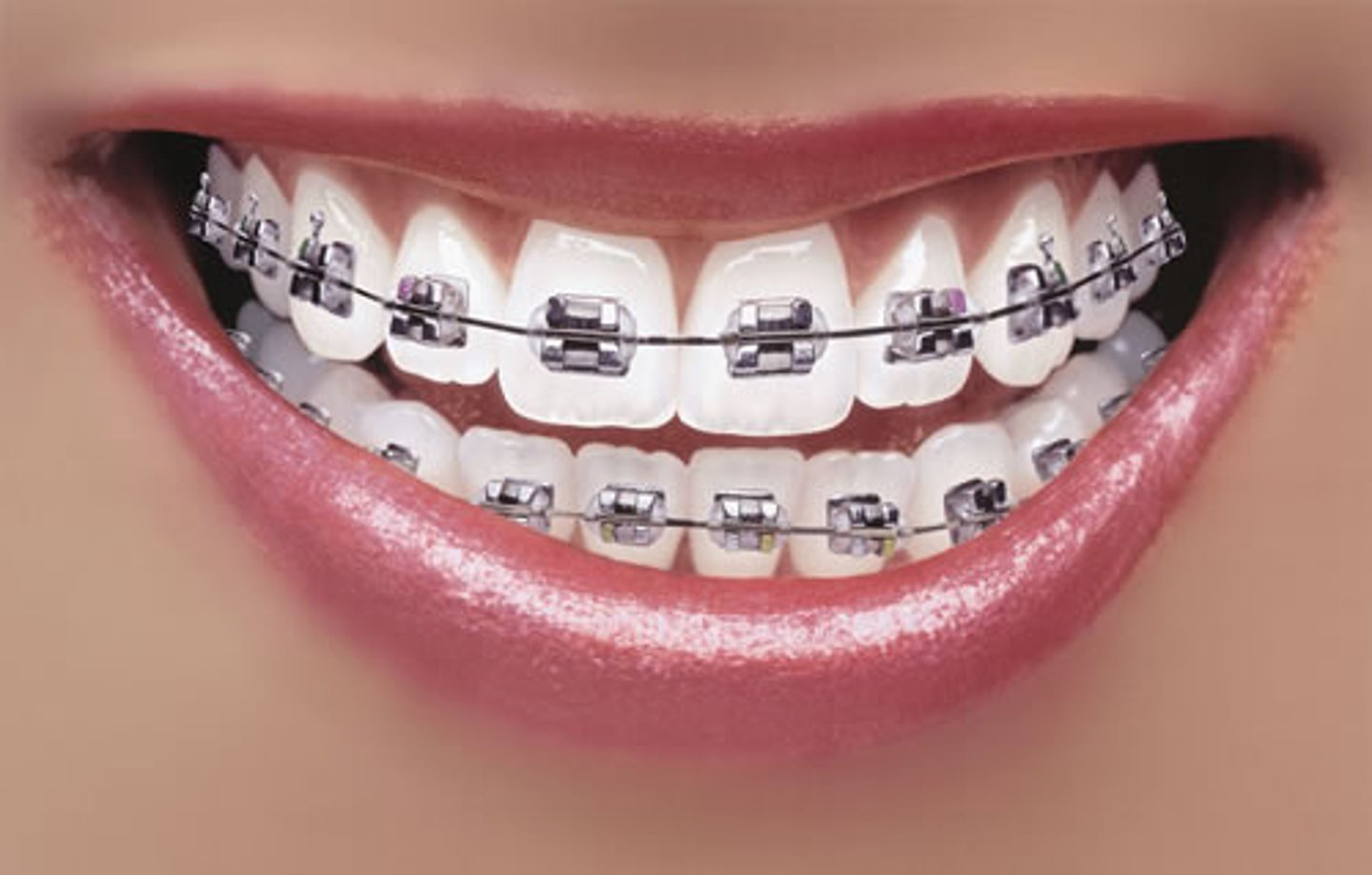 <p>Alloy that 'remembers' its original shape and returns to it when heated.</p>