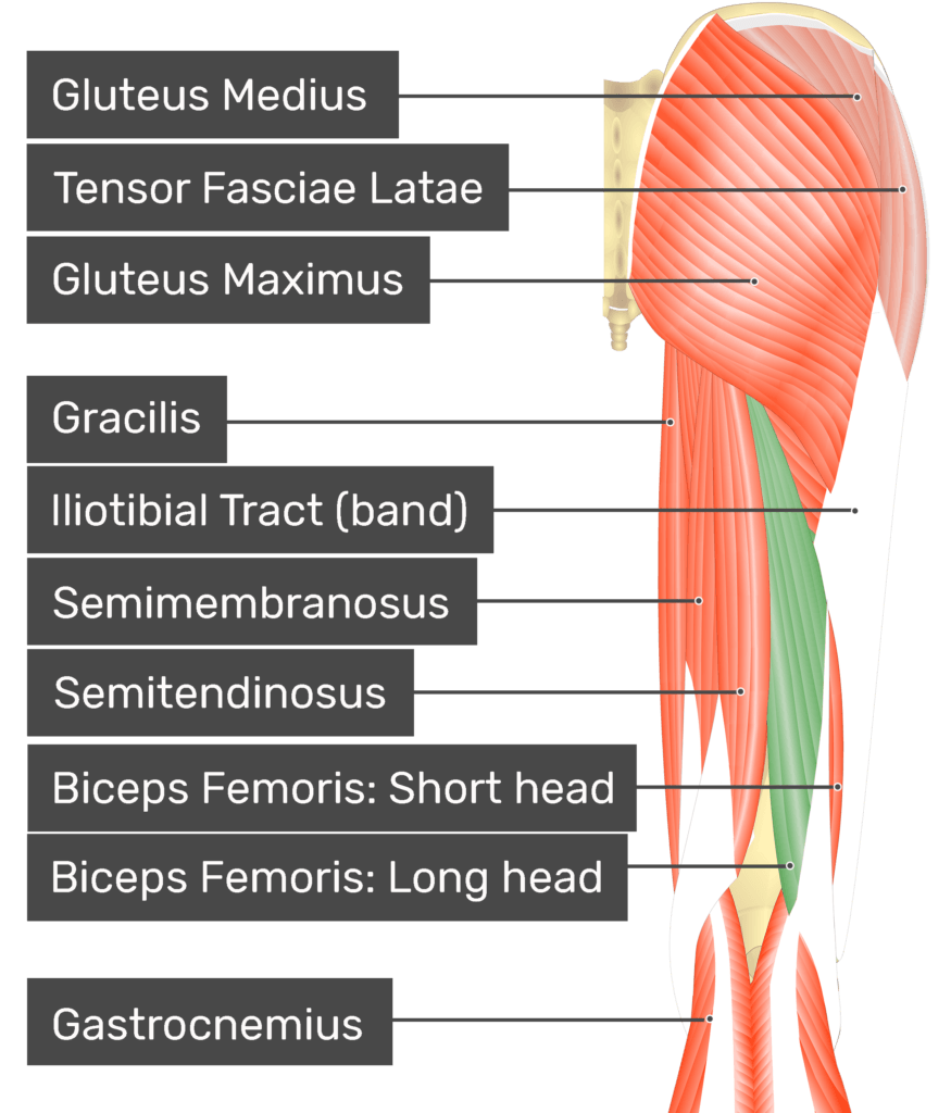 <p>biceps femoris (long head and short head)</p>