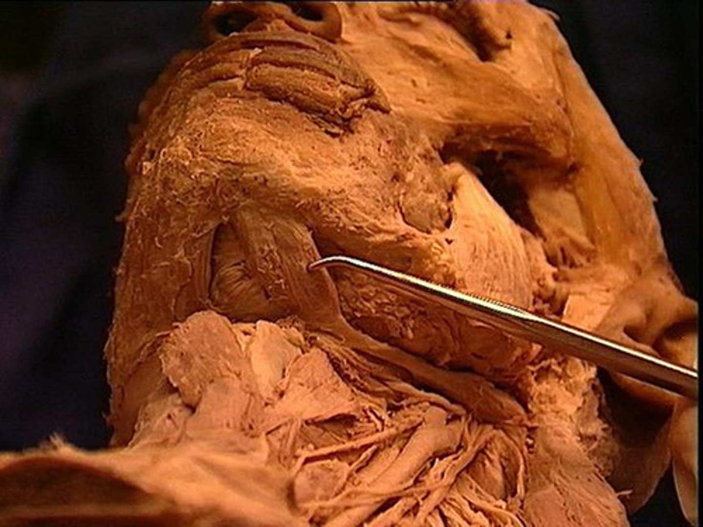 <p>What muscle is this?</p>