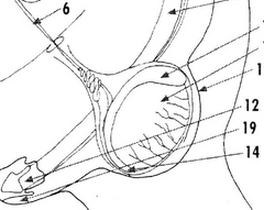 <p>In this diagram, the ductus deferens is leaving the epididymis on the cranial ventral aspect of the testicle. In which three species is this the case?</p>