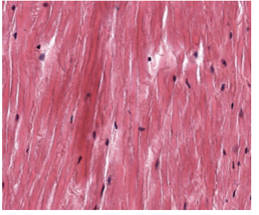 <p>tendons and ligaments; connect muscles to bones, bones to bones.&nbsp;</p>