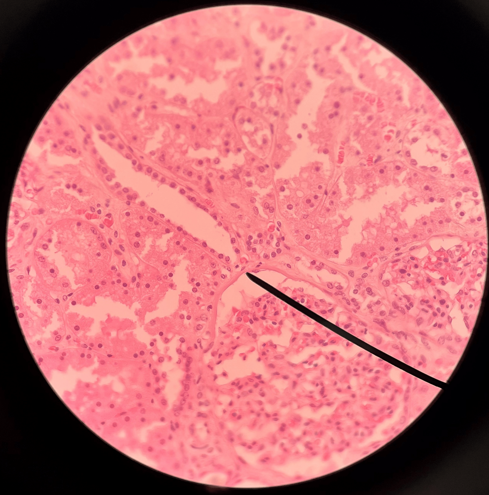 • Slide histology of the nephron.

• Part of a renal corpuscle.

• A wall enclosing the glomerulus.

• Shown in the image is the parietal layer.