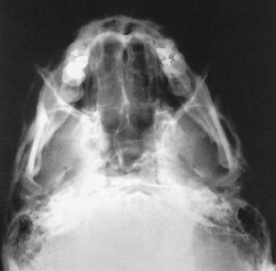 <p>What is this x-ray demonstrating?</p>