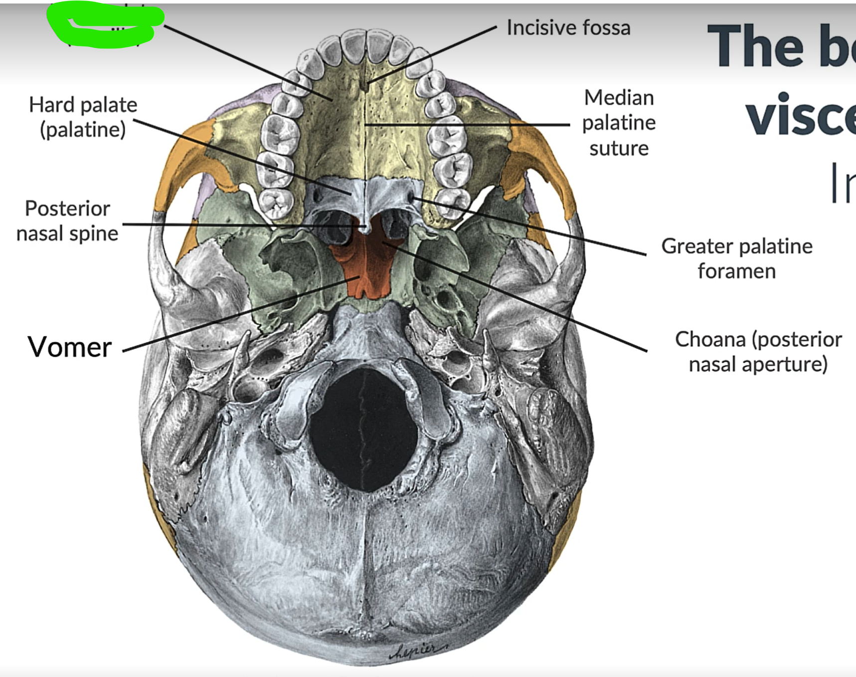 term image