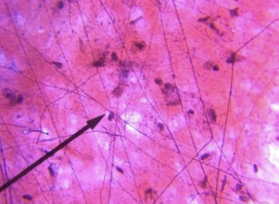 <p>what type of tissue is this </p>