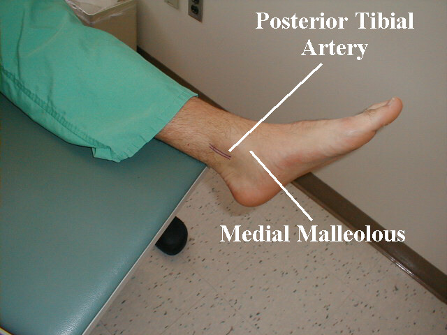 <p>artery supplying the foot, behind the medial ankle</p>