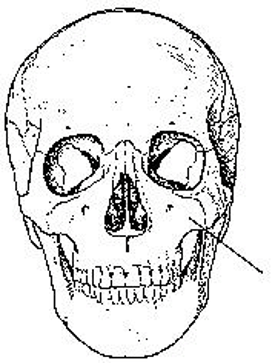 <p>What bone is identified?</p>