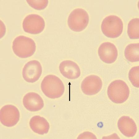 <p>What is the shape of this erythrocyte?</p>