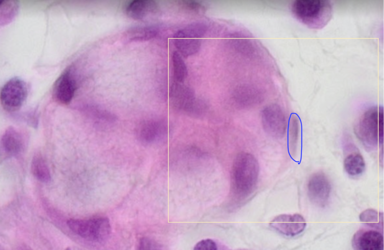 <p>Rundt om <strong>sekretoriske endestykker</strong> og intercalated ducts</p><p>Flade simpel pladeepithel, hvor der ikke er andre cellekerner der er rykket væk (så man er sikker på der ikke ses på en blanding af muscøs og serøs). De sidder helt klistret op af basallamina og mellem epithel. De ligger indenfor sekretorisk endestykkes basalmembran.</p>