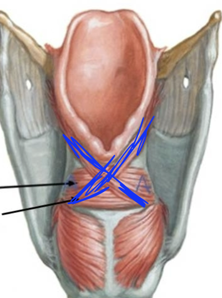 <p>What is this muscle?</p>