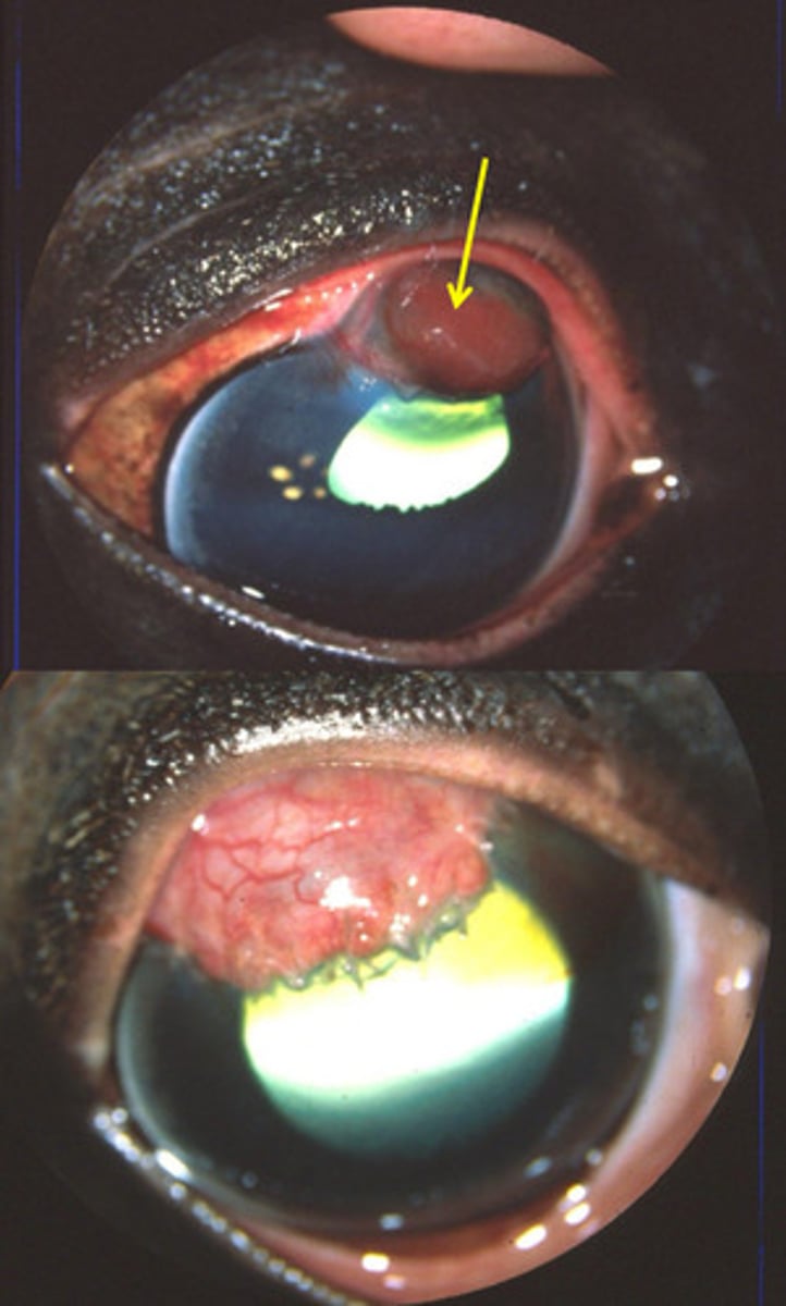 <p>What is happening here after the cornea has ruptured?</p>