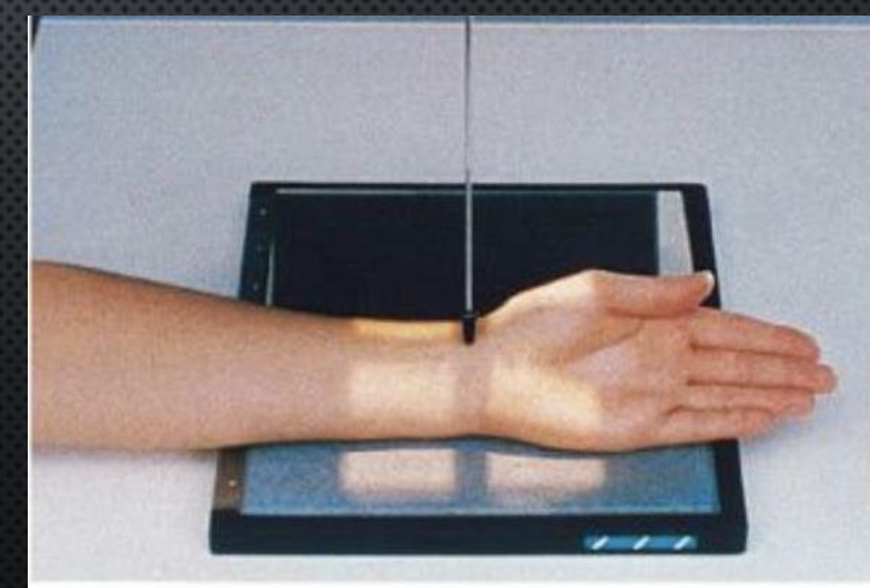 <p>AP oblique (wrist)</p>