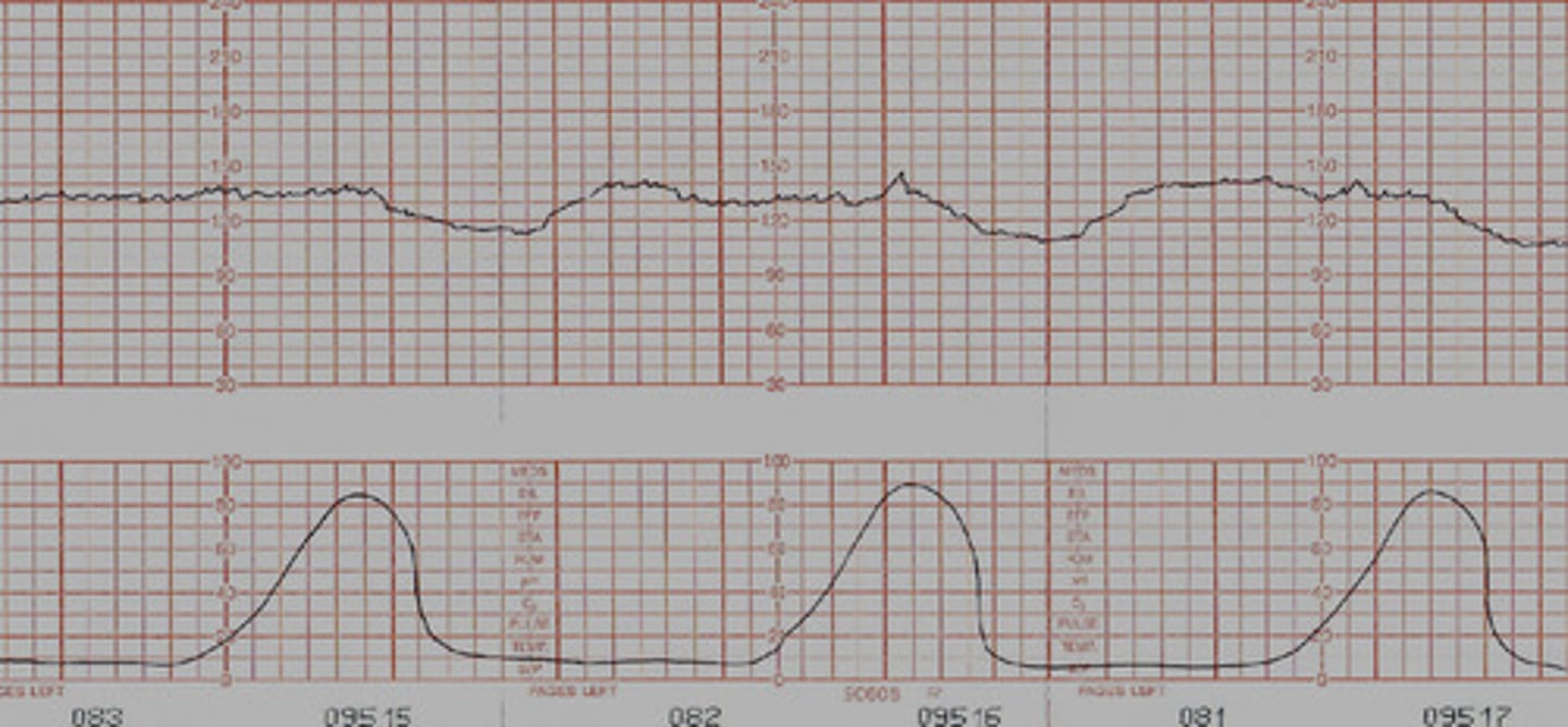 <p>- occur with contractions, fetal baseline is not back up after the contraction is over</p><p>- NOT GOOD</p><p>-immediately call to provider, letting them know what you are seeing, and what you have done</p>