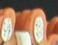 <p>Papillary layer</p>