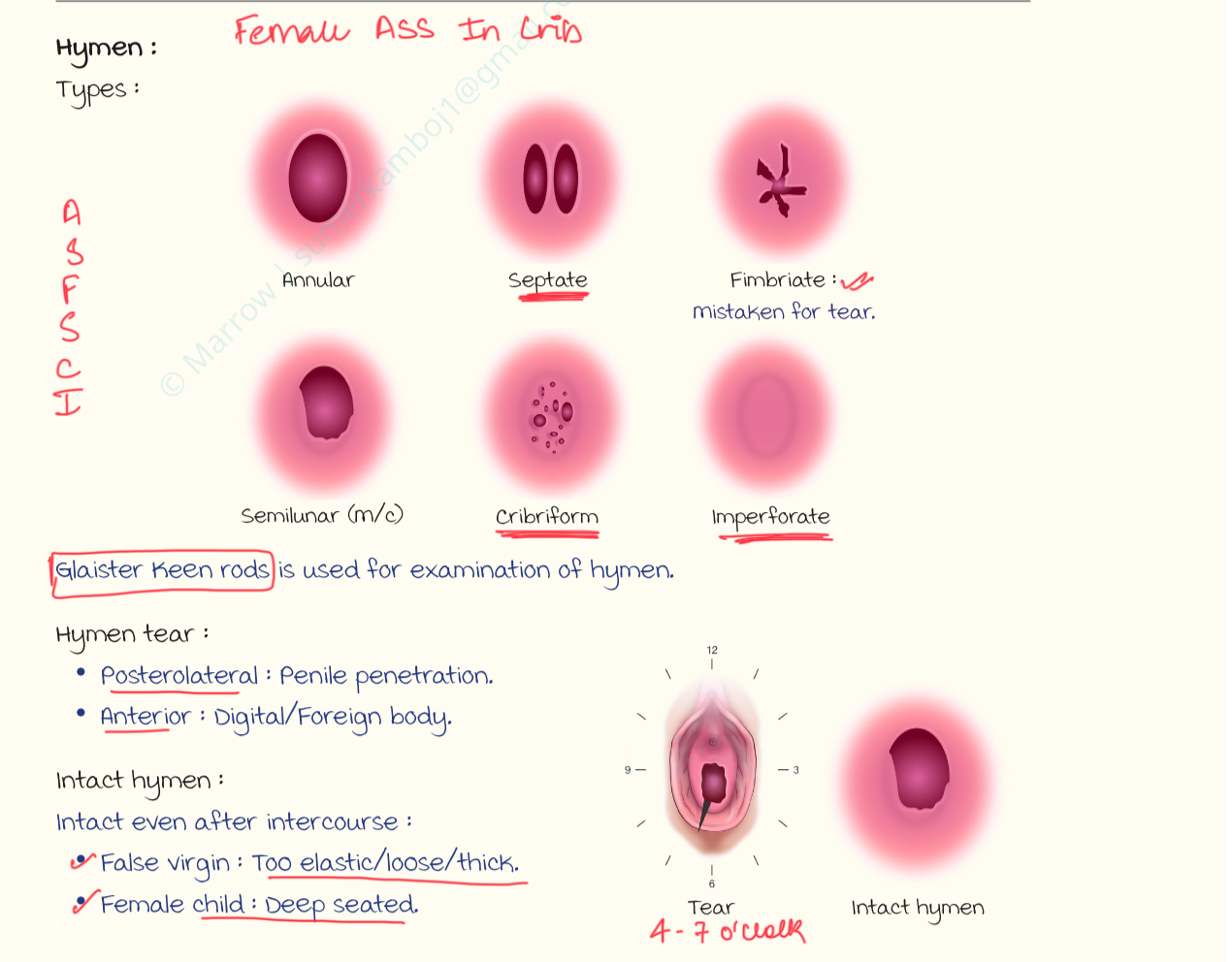<p>Hymen is a fold of muosal membrane in the vaginal orifice.</p><p>Medicolegal importance:</p><p class="has-focus is-empty"></p><p>①nullity of marriage : on grounds of non consummation.</p><p class="has-focus is-empty"></p><p>② Grounds of divorce: concealment of non virgin state by woman</p><p class="has-focus is-empty"></p><p>③ Rape: incondusive evidences; index of sexual assault</p><p class="has-focus is-empty"></p><p>④ Defamation</p>