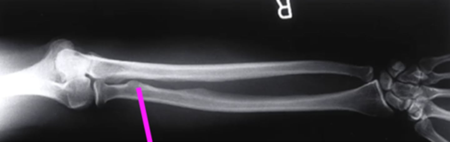 <p>what does this pink line point to?</p>