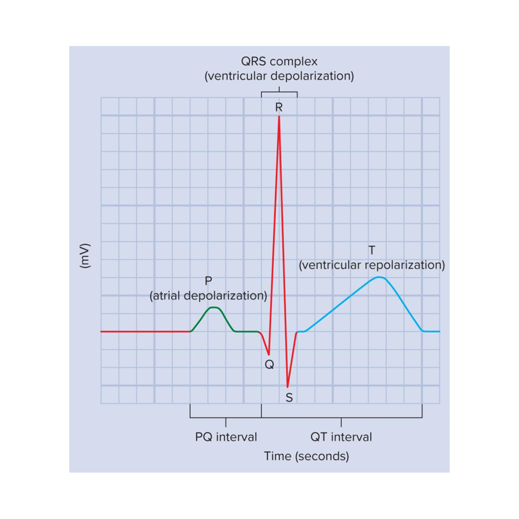 <p>atrial depolarization</p>