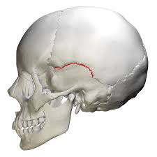 <p>what type of suture is this </p>