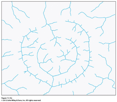 welk drainage patroon zie je hier?
