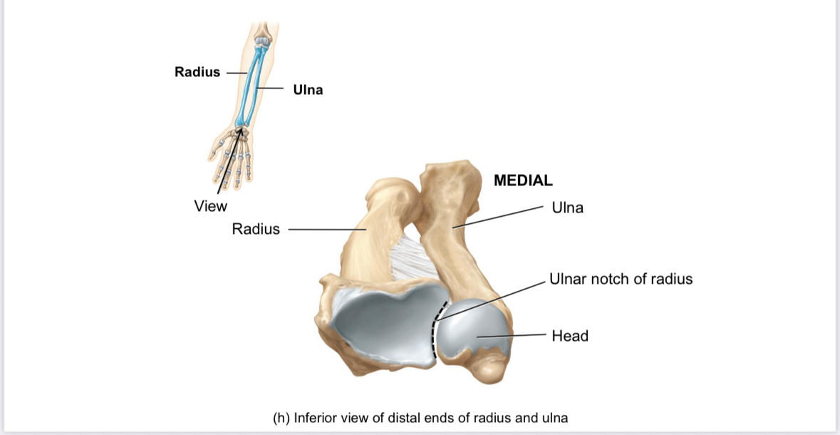 <p>Radius: ulnar notch</p>