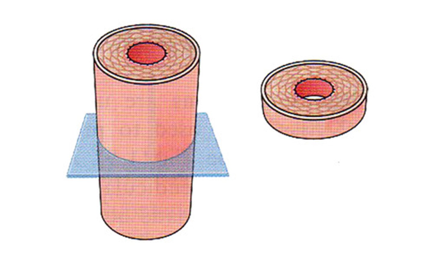 <p>when organs are sectioned along the transverse plane</p>