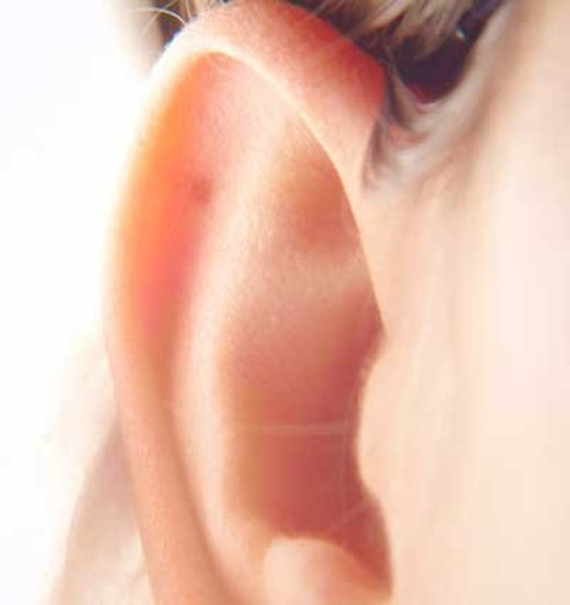 <p>ear (outer)</p>