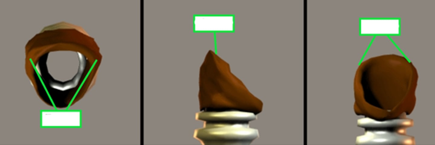 <p>on both sides - serves to hold the thyroid in place.</p><p>also has a pair on top which holds the next part we install</p>