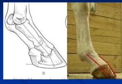 <ul><li><p><span style="background-color: transparent;"><strong><u><span>Under-Run Heels&nbsp;</span></u></strong></span></p><ul><li><p><span style="background-color: transparent;"><strong><span>Et:</span></strong><span> </span></span><span style="background-color: transparent; color: red;"><span>Long Toe–Low Heel</span></span><span style="background-color: transparent;"><span> → </span><u><span>improper trimming, inactivity</span></u></span></p></li><li><p><span style="background-color: transparent;"><strong><span>Cs:</span></strong><span> “Broken back” </span></span><span style="background-color: transparent; color: red;"><span>hoof &lt; pastern axis</span></span><span style="background-color: transparent;"><span>, </span><u><span>white line </span></u><span>separation, heel </span><u><span>bruising</span></u><span>, arthritis, </span><u><span>suspensory + coffin joint strain</span></u></span></p></li><li><p><span style="background-color: transparent;"><strong><span>Tx:</span></strong><span> corrective trimming&nbsp;</span></span></p></li></ul></li></ul><ul><li><p><span style="background-color: transparent;"><strong><u><span>Short Toe-High Heel</span></u></strong></span></p><ul><li><p><span style="background-color: transparent;"><strong><span>Cs:</span></strong><span> </span></span><span style="background-color: transparent; color: red;"><span>hoof &gt; pastern axis</span></span><span style="background-color: transparent;"><span>, chronic </span><u><span>sole bruising</span></u><span>, arthritis, </span><u><span>suspensory + coffin joint strain</span></u></span></p></li><li><p><span style="background-color: transparent;"><strong><span>Tx:</span></strong><span> corrective trimming&nbsp;</span></span></p></li></ul></li></ul><p></p>