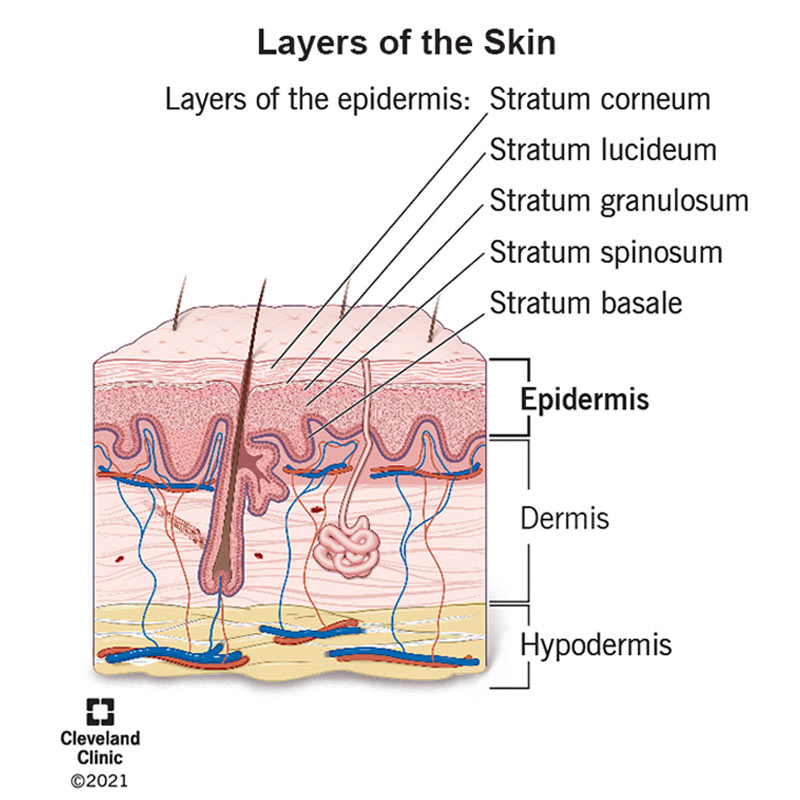 <p>-stratum basale layer (deepest layer of epidermis)</p>