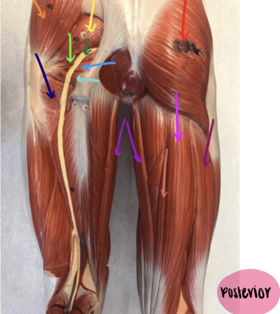 <p>ID the structure of the red arrow.</p>
