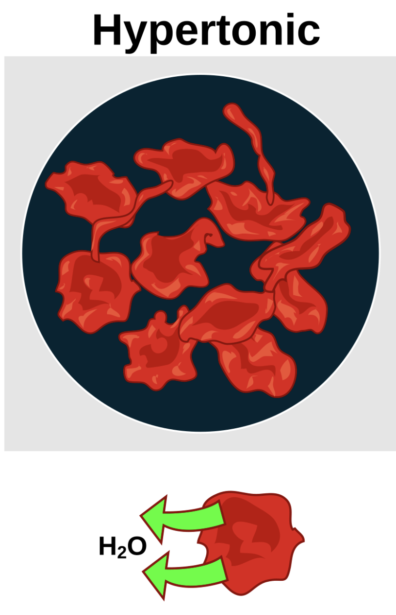 <p>A solution that has a higher concentration of solutes compared to the inside of a cell, causing water to flow out of the cell, leading to the cell to shrivel.</p>