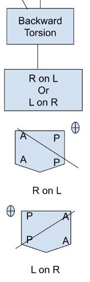 <ul><li><p>axis is opp. of lateralization (seated flexion test)</p></li><li><p>R on L → right sulci + ILA both post.</p></li><li><p>L on R → left sulci + ILA both post.</p></li></ul><p></p>