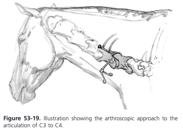 <ul><li><p><span>Arthroscopic Evaluation of the Cervical Articular Process Joints</span></p><ul><li><p><span>Access to the cervical articular processes (CAP) can be achieved using arthroscopic instrumentation via a lateral neck approach</span></p></li><li><p><span>Lateral recumbency with slight ventroflexion</span></p></li><li><p><span>Ultrasonography used to assist insertion of the arthroscope and avoid the large vertebral vessels</span></p></li><li><p><span>CAPs consist of a cranioventral and caudodorsal recess</span></p></li></ul></li></ul>