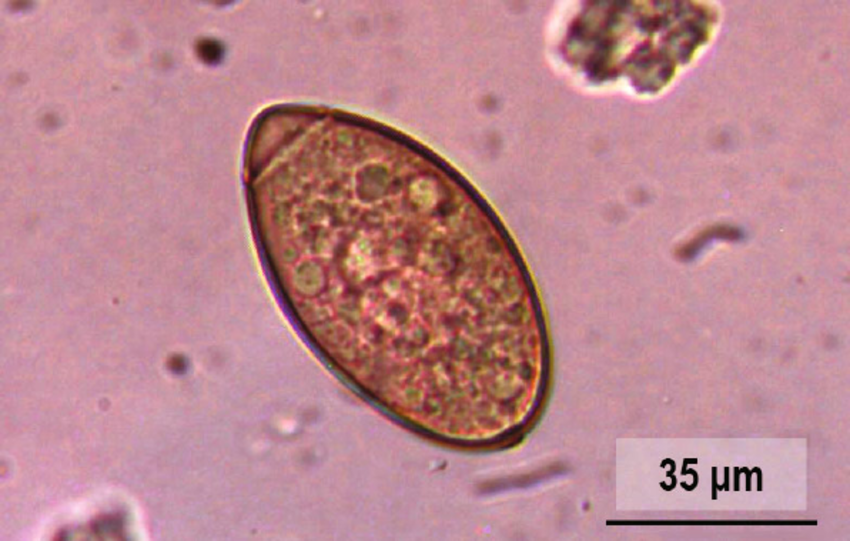 <p><em>Spirometra mansonoides</em></p><p></p><p>Psuedocyclophyllidean tapeworm</p><ul><li><p>Operculated egg</p></li></ul><p></p>
