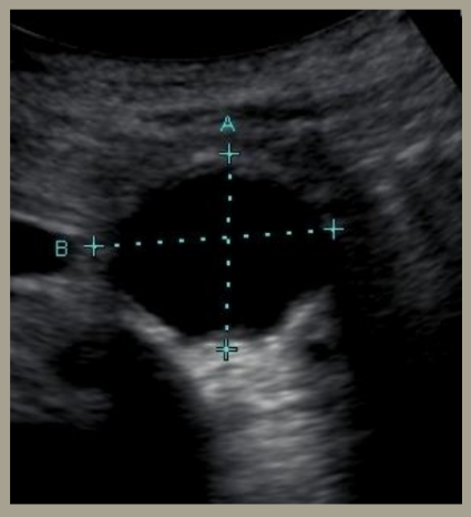 <p>what tool is this image showing?</p>